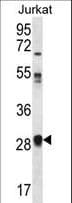 OR11L1 Antibody (aa279-308)