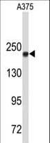 TOP2A / Topoisomerase II Alpha Antibody (aa1167-1196)