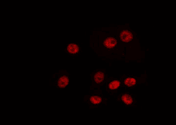 Polyclonal Rabbit anti-Human HOXA6 Antibody (IF, WB)