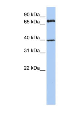 MPP5 Antibody (aa36-85)