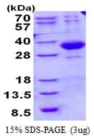 Human SPSB2 Protein (Recombinant His)