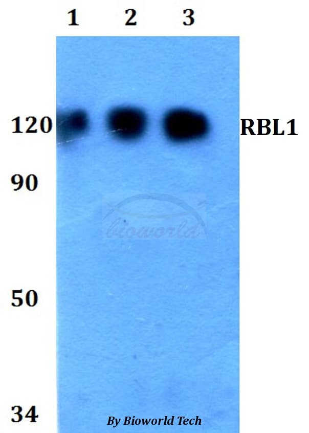 Polyclonal Rabbit anti-Human RBL1 / p107 Antibody (WB)