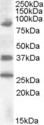 IHC-plus™ HOXD10 Antibody (aa84-97)