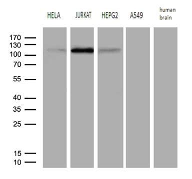 HPMS1 / PMS1 Antibody (aa323-423, clone OTI5E10, Carrier-free)