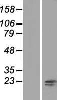RNF181 Protein (Over-Expression Lysate Myc-DDK (Flag))