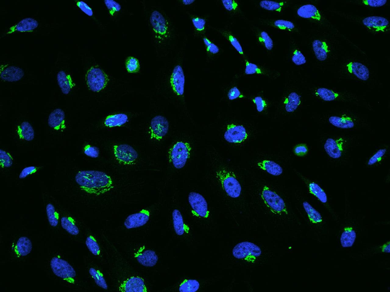 Polyclonal Rabbit anti-Human B4GALT1 Antibody (IHC, IF)