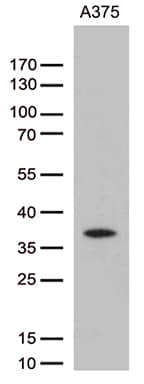 Monoclonal Mouse anti-Human HOXD8 Antibody (clone OTI3C4, aa69-290, WB)