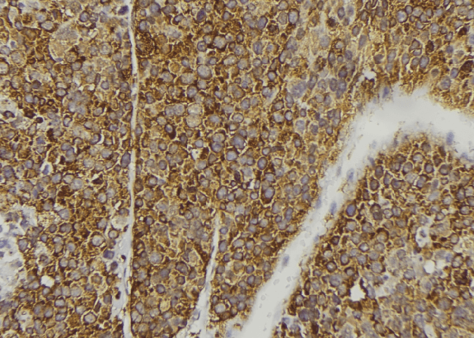 FGF3 Antibody