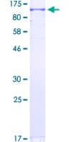 Human UBR3 Protein (Recombinant GST)