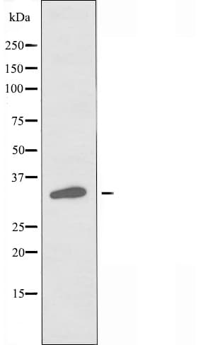OR2M2 Antibody
