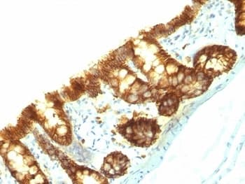EPCAM Antibody (clone Epcam/1159)