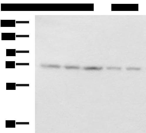 Polyclonal Rabbit anti-Human PAIP1 Antibody (IHC, WB)
