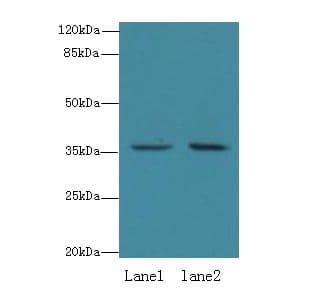 EEF2KMT / FAM86A Antibody (aa1-330)