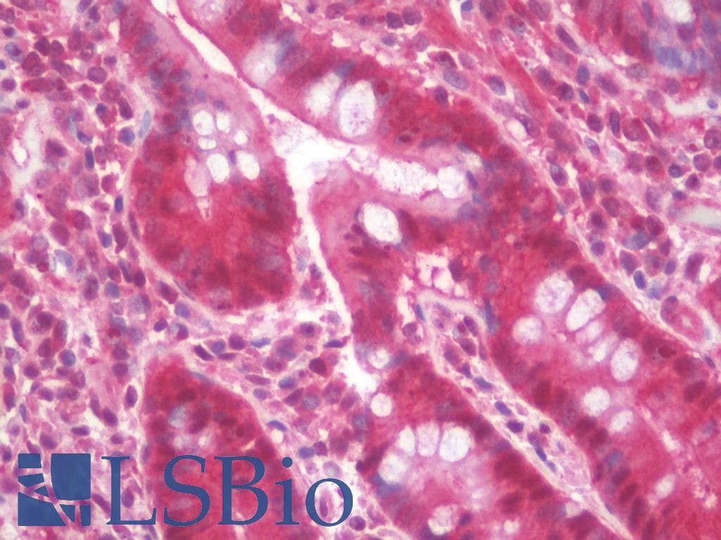 IHC-plus™ Polyclonal Rabbit anti-Mouse ATG5-ATG12 Complex Antibody (aa262-275, IHC, WB)