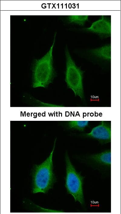 PPA1 Antibody (aa1-289)