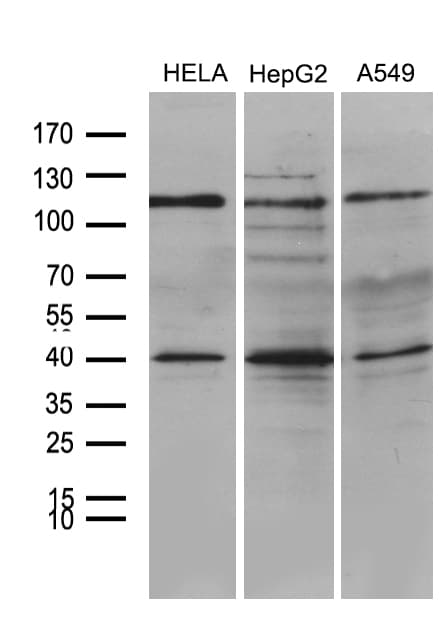 PHF20L1 Antibody (clone OTI1B4)