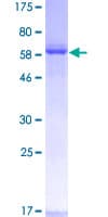 Human ZWINT Protein (Recombinant GST)