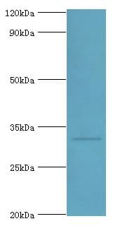 Polyclonal Rabbit anti-Human CASP6 / Caspase 6 Antibody (aa24-293, IHC, WB)