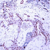 Polyclonal Rabbit anti-Human PR / Progesterone Receptor Antibody (IHC, IF, WB)