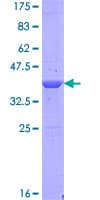 Human WDR9 / BRWD1 Protein (Recombinant GST)