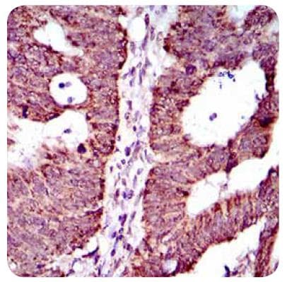 ABCG5 Antibody (aa300-500, clone 1B5E10)