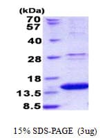 Human LAMTOR2 Protein (Recombinant His)