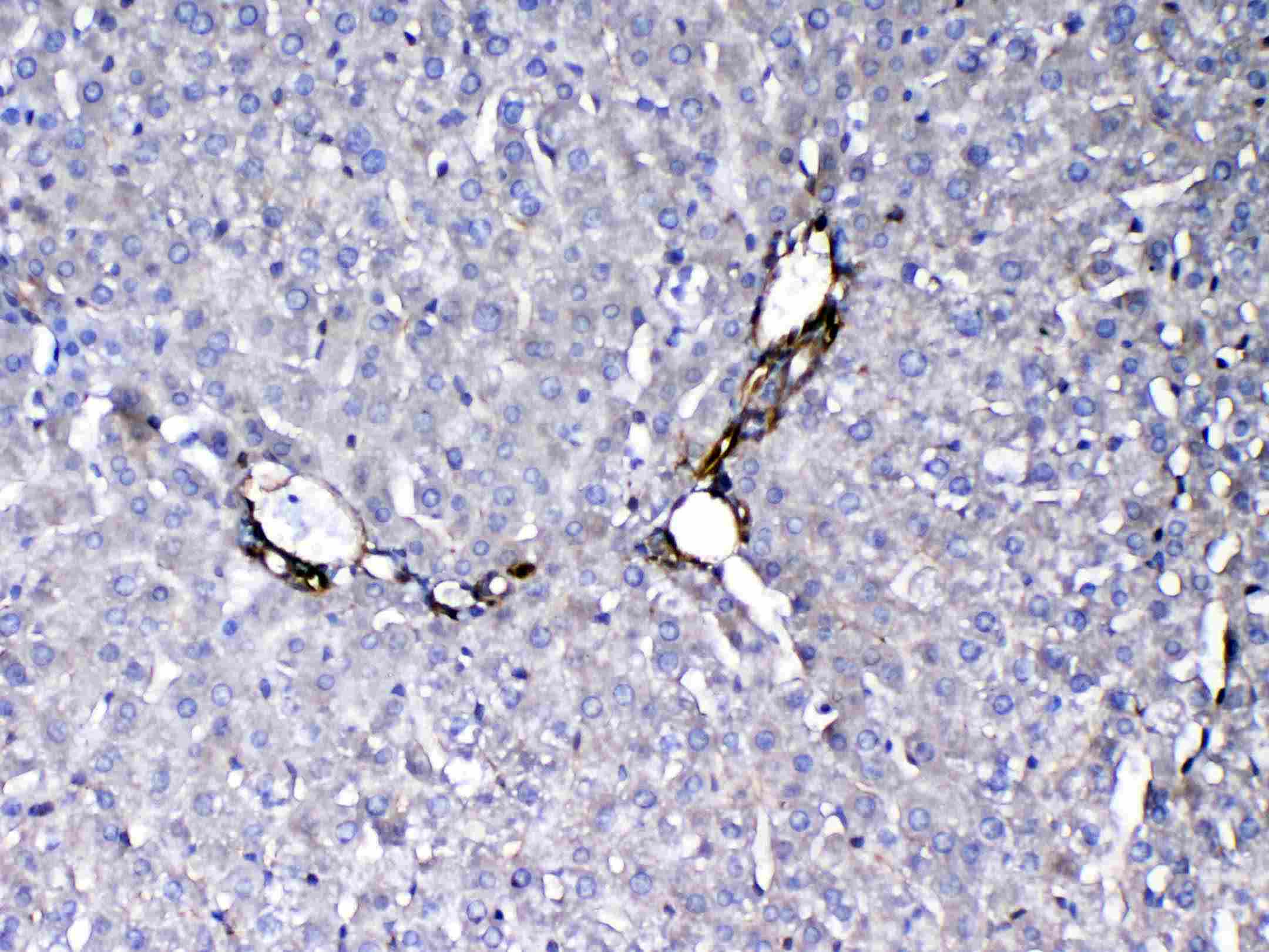 FLT4 / VEGFR3 Antibody