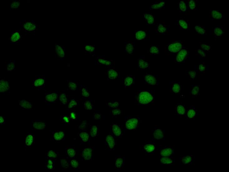 PLCG2 / PLC Gamma 2 Antibody