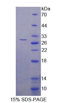 Human LRRC3C Protein (Recombinant His-T7, N-terminus)