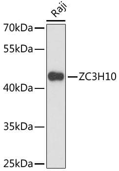 Polyclonal Rabbit anti-Human ZC3H10 Antibody (WB)
