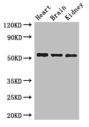 SH3BP5 / SAB Antibody