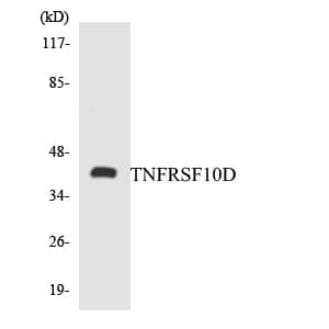 IHC-plus™ TRAIL-R4 / DCR2 Antibody (aa105-154)