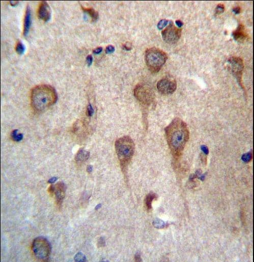 Polyclonal Rabbit anti-Human GPHB5 Antibody (aa62-91, IHC, WB)