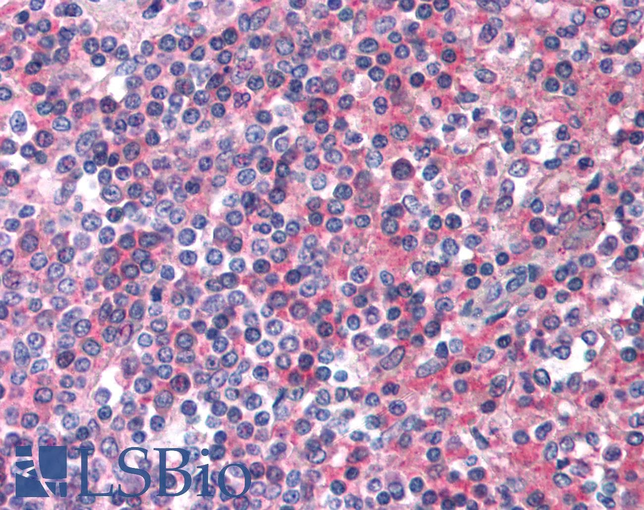 IHC-plus™ ADGRE2 / EMR2 Antibody (N-Terminus)
