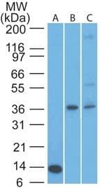 Monoclonal Mouse anti-Human CRLF2 / TSLPR Antibody (clone 59N5G4, aa119-231, IHC, WB)