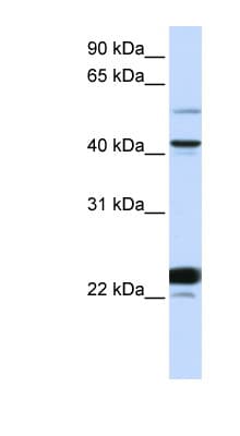 Polyclonal Rabbit anti-Human EVX1 Antibody (aa36-85, WB)