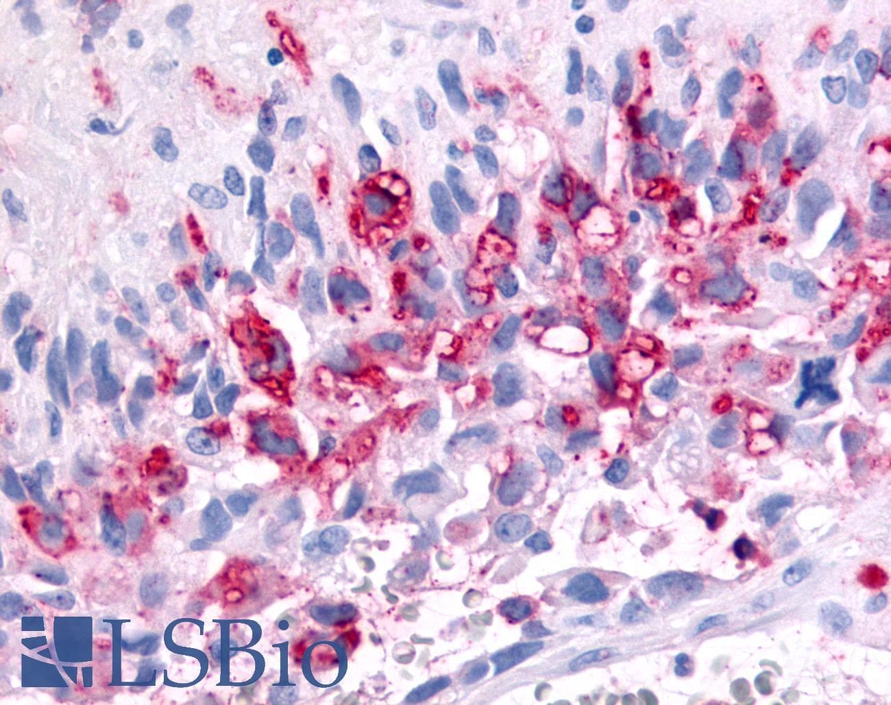 PathPlus™ Polyclonal Rabbit anti-Human PRKD2 / PKD2 Antibody (Internal, IHC)