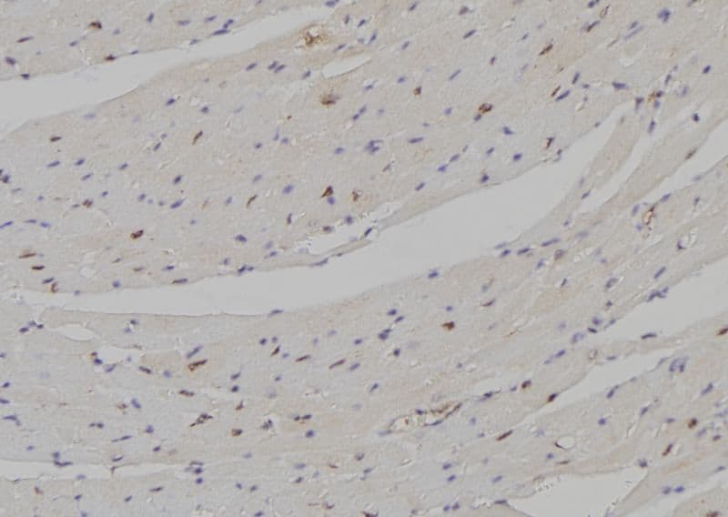 Polyclonal Rabbit anti-Human DLX5 Antibody (IHC, IF, WB)