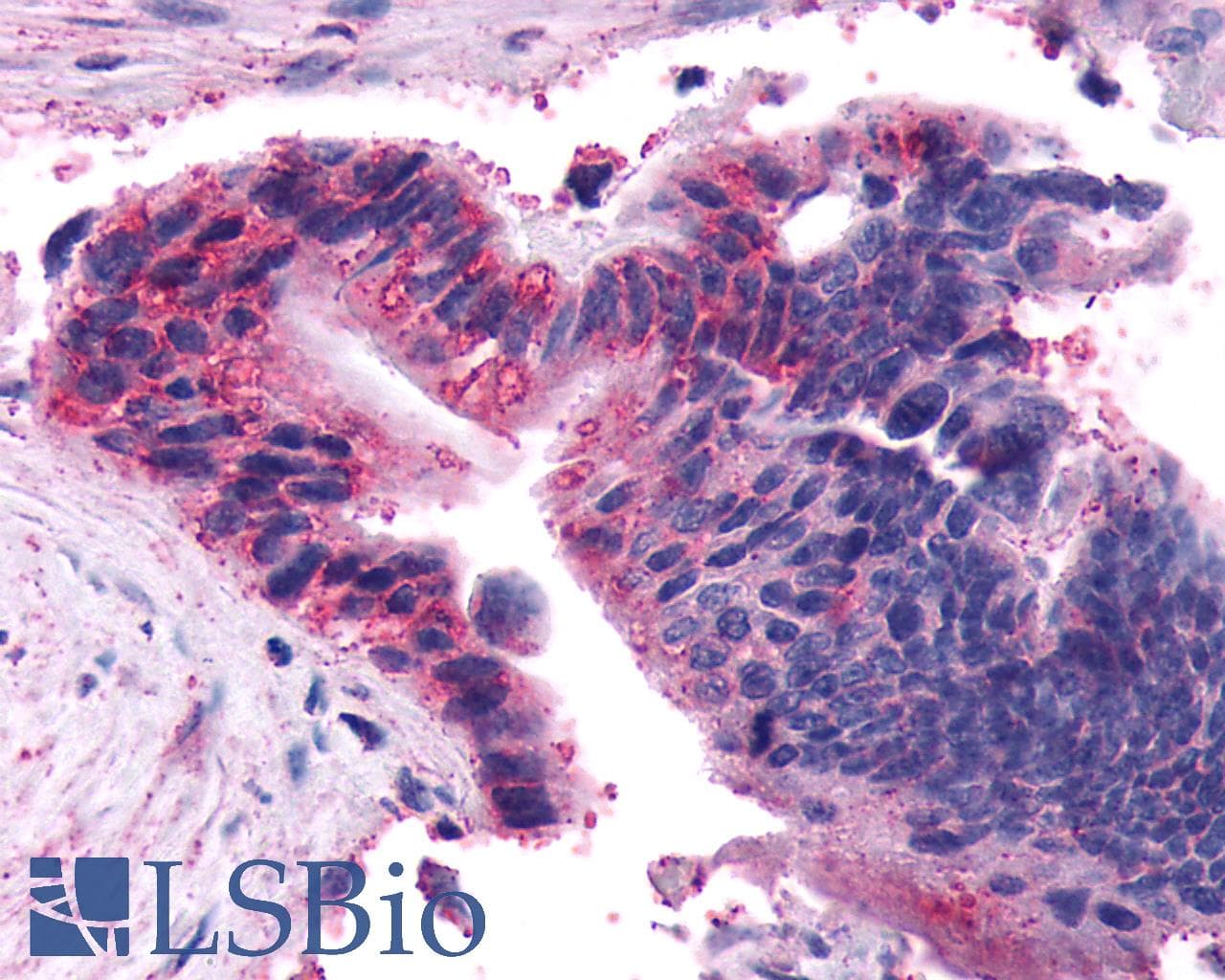 PathPlus™ FZD5 / Frizzled 5 Antibody (N-Terminus)