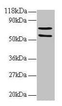 IHC-plus™ SDHA Antibody