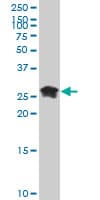 IHC-plus™ Monoclonal Mouse anti-Human HMG2 / HMGB2 Antibody (clone 3D2, IHC, IF, WB)