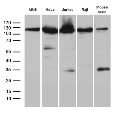 Monoclonal Mouse anti-Human IPO5 / RANBP5 Antibody (clone OTI1C5, aa1-220, WB)