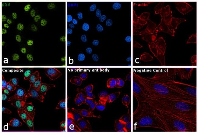 Tumor suppressor p53 Antibody (clone 4A8)
