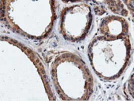 ILVBL Antibody (clone OTI8A12)