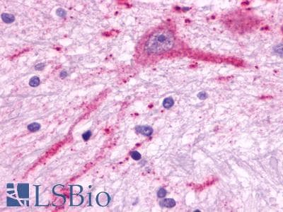IHC-plus™ Polyclonal Rabbit anti-Human MCHR2 Antibody (C-Terminus, IHC)