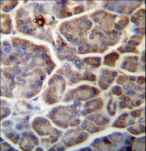 SNX29 / RUNDC2A Antibody (aa710-739)