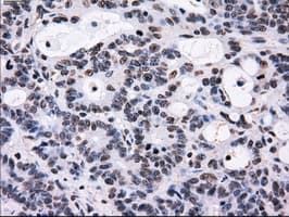 Monoclonal Mouse anti-Human ID3 Antibody (clone OTI12C7, IHC, IF, WB)