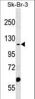 Polyclonal Rabbit anti-Human MTMR4 Antibody (aa695-723, WB)