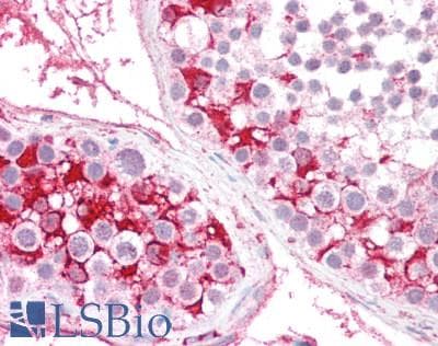 IHC-plus™ Polyclonal Rabbit anti-Human CACNA1E / Cav2.3 Antibody (IHC, WB)