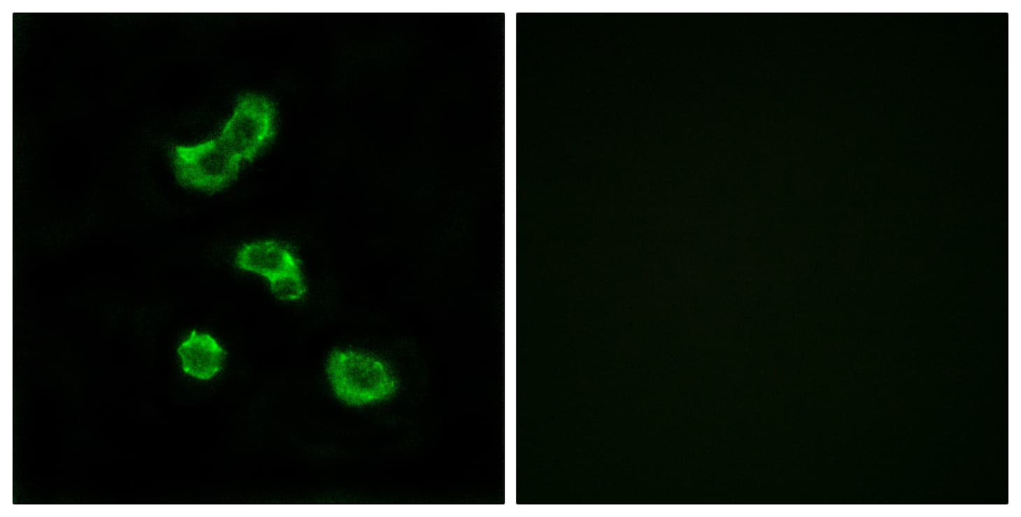 CA-VB / CA5B Antibody (aa241-290)